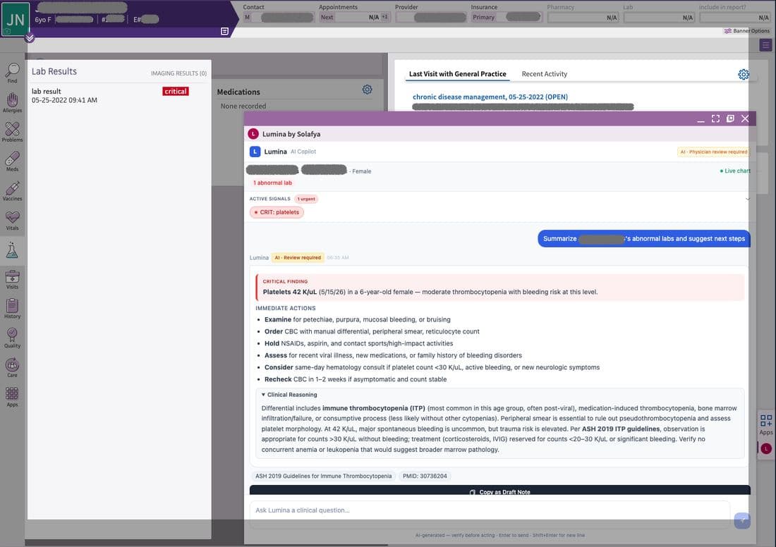 Lumina AI copilot panel inside an athenaOne patient chart, flagging critical thrombocytopenia in a 6-year-old with cited ASH 2019 guidelines
